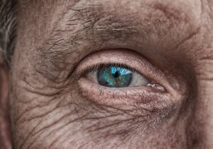 髪年齢を若返る薄毛専門クリニックで改善する方法は？